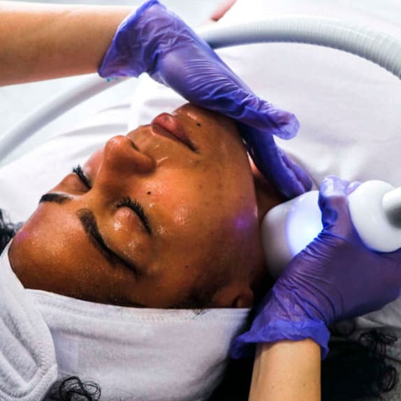 Cryofacial