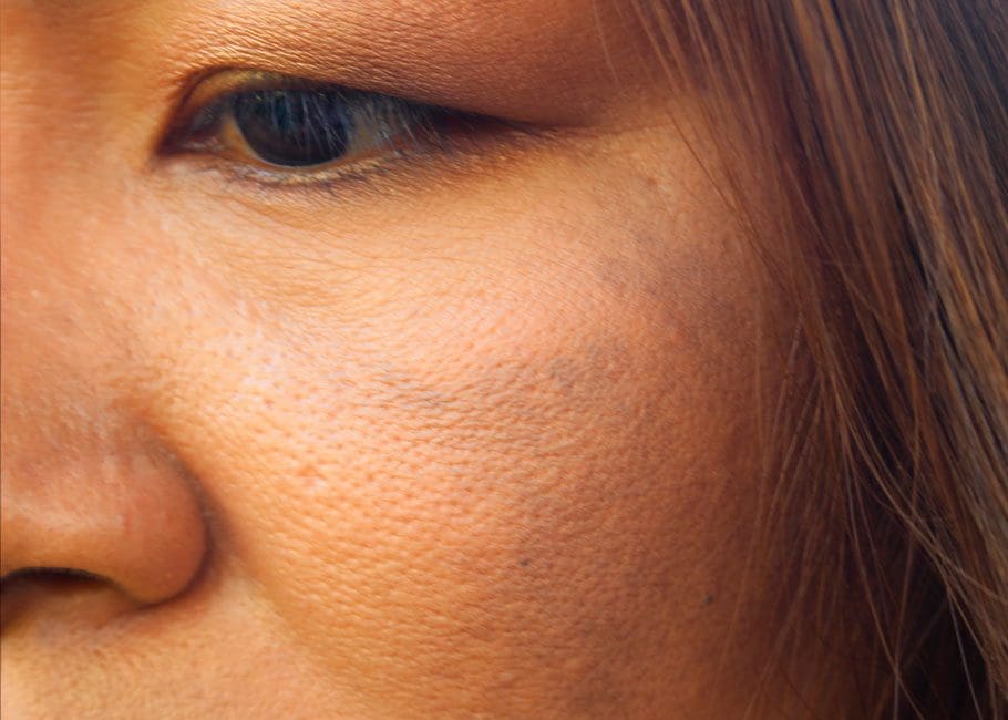 Large Pores