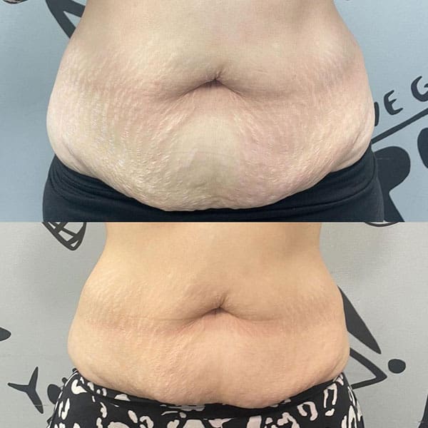 cryostar - Before and After 1