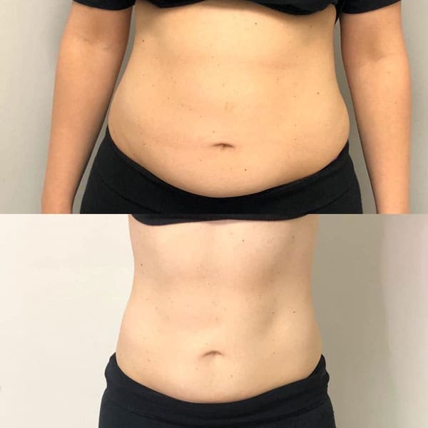 cryostar - Before and After 2