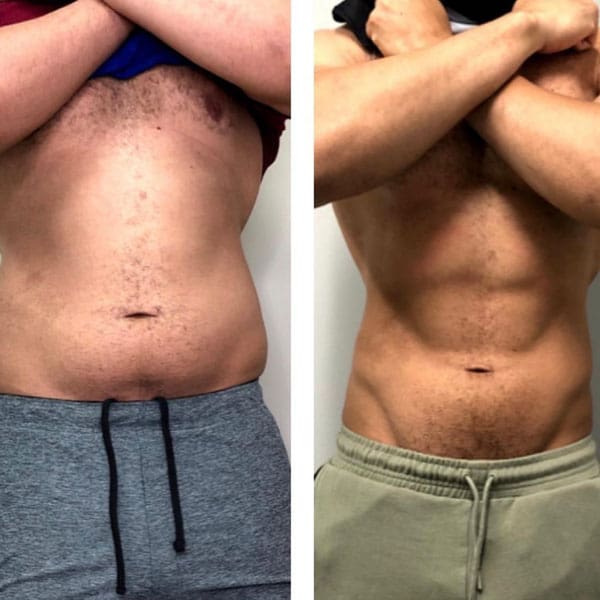 cryostar - Before and After 3
