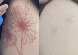 After 2 Sessions
