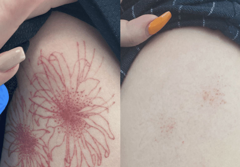 After 2 Sessions