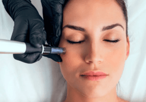 Microneedling Aftercare